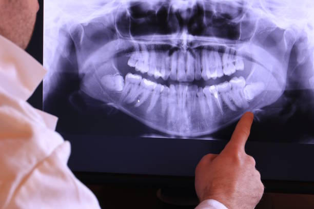 Best Emergency Treatment for Oral Infections in Independence, KY